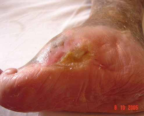 Figura 7