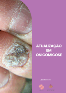 ONICOMICOSE