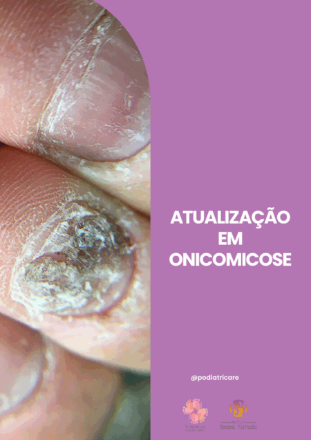 ONICOMICOSE